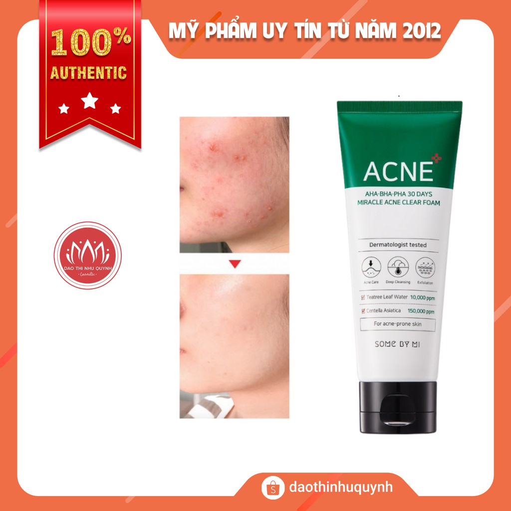 SỮA RỬA MẶT AHA BHA PHA Some By Mi 30 DAYS HỖ TRỢ GIẢM MỤN Miracle Acne Clear Foam 100ml