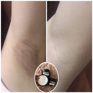 KEM THÂM BIKINI 50gram