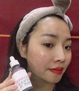 Redpeel serum fullsize và chiết 10ml