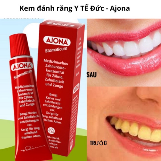 KEM ĐÁNH RĂNG AJONA TUÝP 25ML LOẠI BỎ CAO VÀ CHỐNG VIÊM LỢI