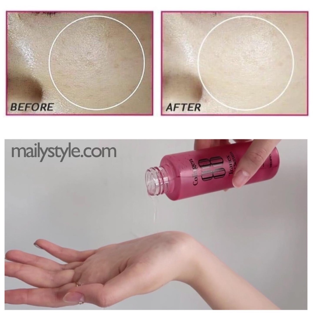 SERUM DẠNG XỊT 88% COLLAGEN CỦA MEDIPICKME GIẢM NÁM-LÀM TRẮNG DA | BigBuy360 - bigbuy360.vn