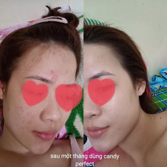 combo 3 Kem face candy  [ tặng kèm quà] | BigBuy360 - bigbuy360.vn