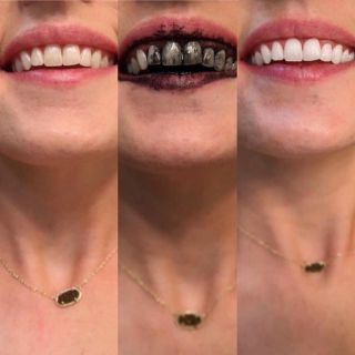 BỘT TRẮNG RĂNG THAN HOẠT TÍNH SIÊU CAO CẤP