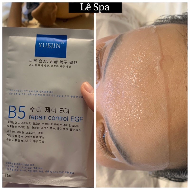 Mặt nạ Yuejin B5 phục hồi da tổn thương, da treatment nhạy cảm