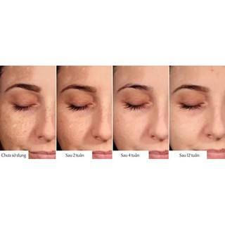 Serum trị thâm, nám Eucerin Ultra White Spotless Double Serum dưỡng trắng da, giúp mờ vết thâm