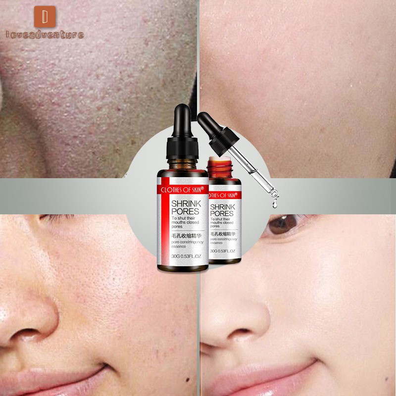 Tinh chất dưỡng ẩm se khít lỗ chân lông loại bỏ mụn đầu đen ! | BigBuy360 - bigbuy360.vn