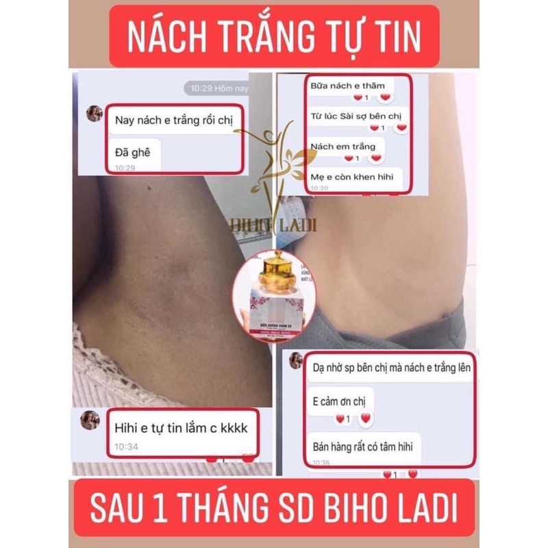 [CHÍNH HÃNG] KEM MỜ THÂM 5S BIHOLADI | BigBuy360 - bigbuy360.vn