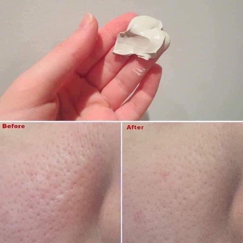 Mặt nạ đất sét dưỡng trắng sạch mụn đầu đen Kiehl's Rare Earth Deep Pore Cleansing Masque