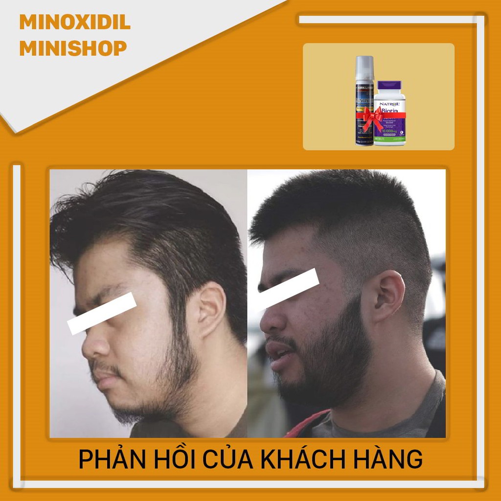 Minoxidil 5% Bọt (Foam) Mọc Râu Tóc kết hợp Biotin