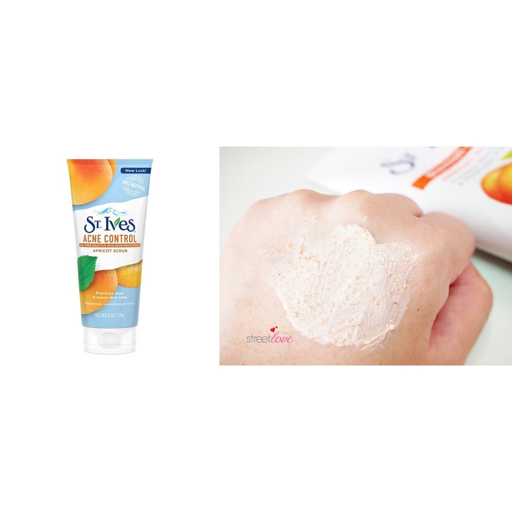 Sữa Rửa Mặt Tẩy Tế Bào Chết Quả Mơ Ngừa Mụn St.Ives 170g Blemish Control Apricot Scrub