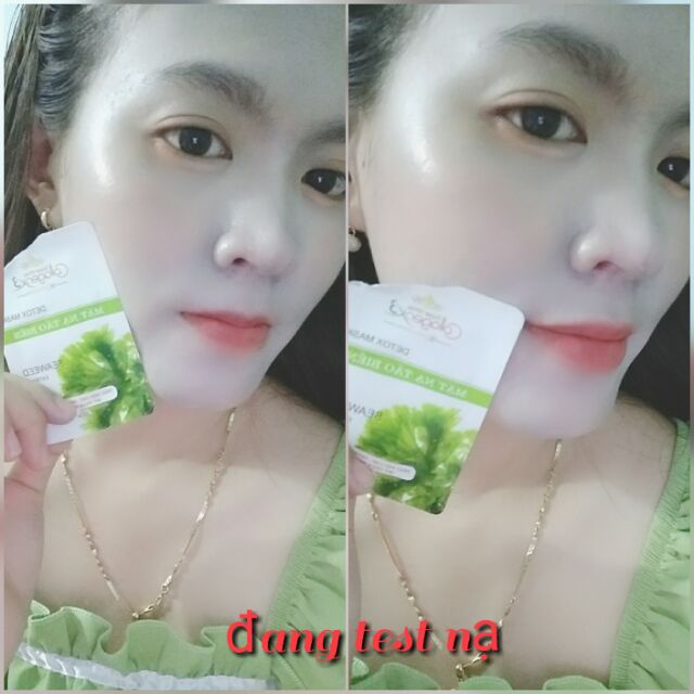 Nạ thải độc chì collagen x3