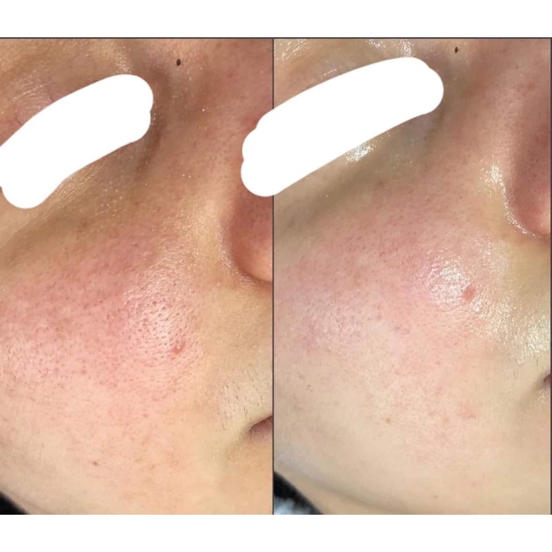 Thay Da Sinh Học Inno LIGHTENING 15g