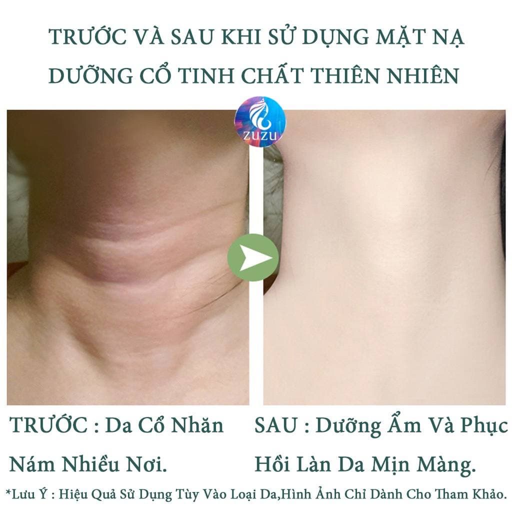 Mặt nạ dưỡng da, dưỡng trắng chăm sóc dưỡng ẩm giảm nếp nhăn giúp da vùng cổ săn chắc LALASKIN