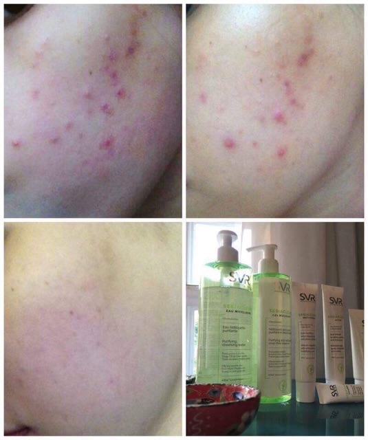 Sữa rửa mặt SVR Sebiaclear gel moussant 400ml | BigBuy360 - bigbuy360.vn