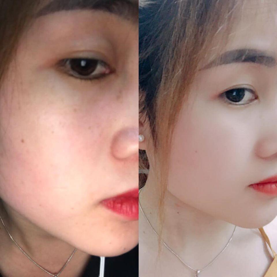 Kem Nám Thái Lan Clobetamil G- Cho Da Sáng Hồng Khỏe Mạnh