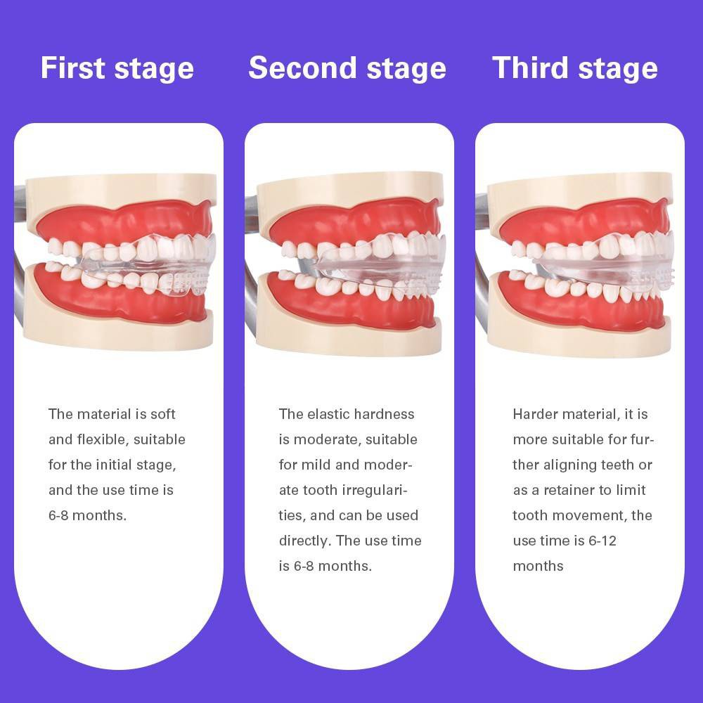 Dụng cụ hỗ trợ chỉnh hình răng chất lượng cao chuyên dụng cho người lớn và trẻ em