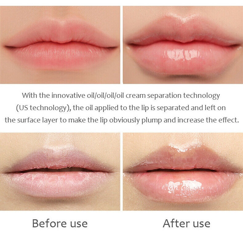 1 Tuýp Kem Dưỡng Môi Căng Mọng Dung Tích 5ml