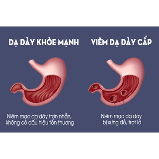 DUNG DỊCH DẠ DÀY FAST GEL