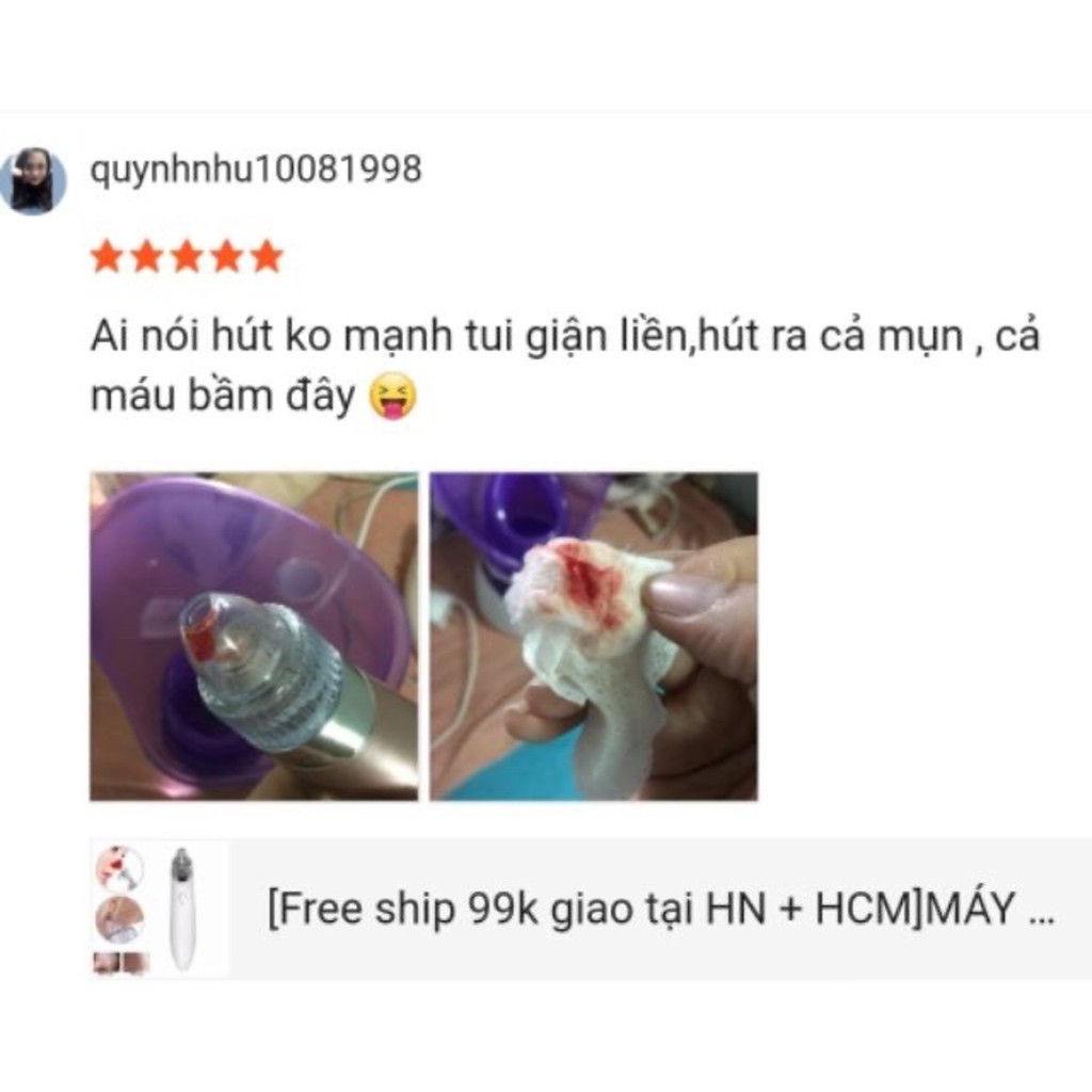 Máy Hút Mụn Cầm Tay 5 Lực Cao Cấp Black Head Detector Dùng Pin Tiểu Siêu Tiện Dụng,