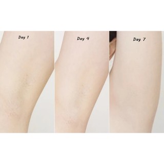 Kem giảm Thâm Nách Vaseline