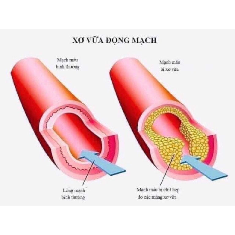 Tinh dầu thông đỏ Chính phủ Hàn Quốc Redpinejeok Songwon 60 viên/120 viên [ Hàng Mới Về ]