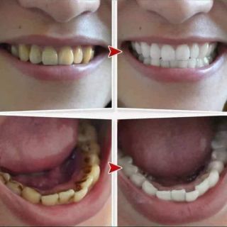 bột than hoạt tính trắng răng minty active