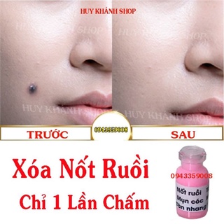 Tẩy Nốt Ruồi Mụn,Mụt Cóc,Tàn Nhang Mụn Thịt,Mắc Cá