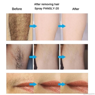 Chai Xịt Ức Chế Mọc Lông Pansly 30ml