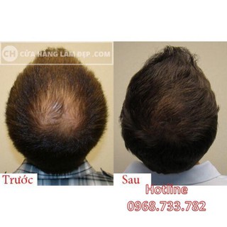 Thuốc bôi kích thích mọc tóc Sato Nhật Bản