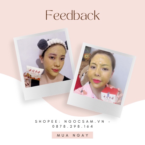 Bộ Ngọc Sâm Mini Mặt Nạ Chưa Pha Ngừa Mụn Trắng Da