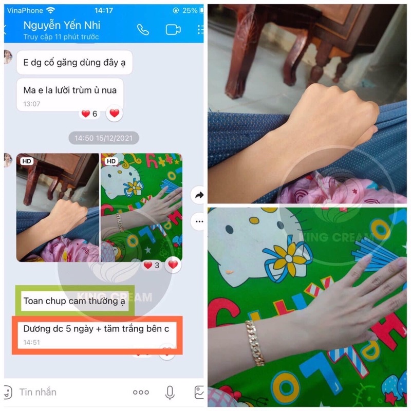 KEM BODY  KING CREAM Hoàng gia Dát Vàng