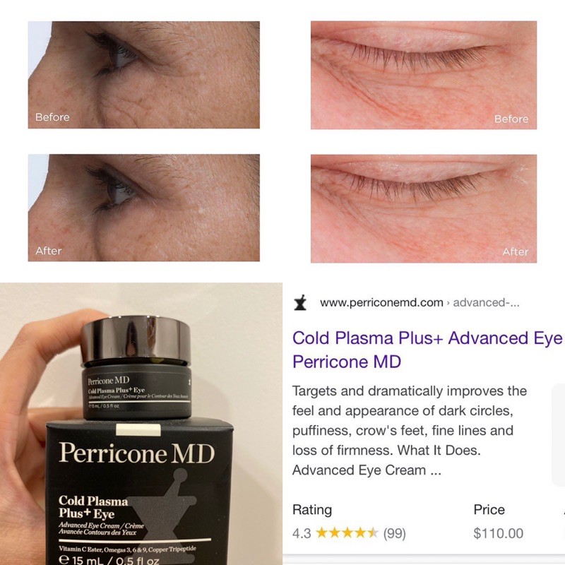 Kem dưỡng mắt Perricone MD Cold Plasma Plus Eye (bill Mỹ)