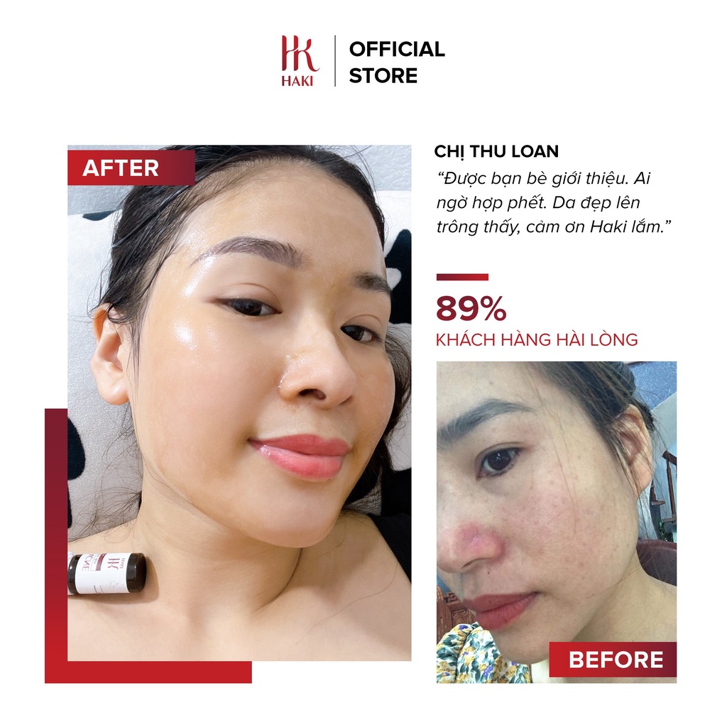 Serum Ngừa mụn HAKI Gingem Acne Sạch Mụn Sáng Da 15ml