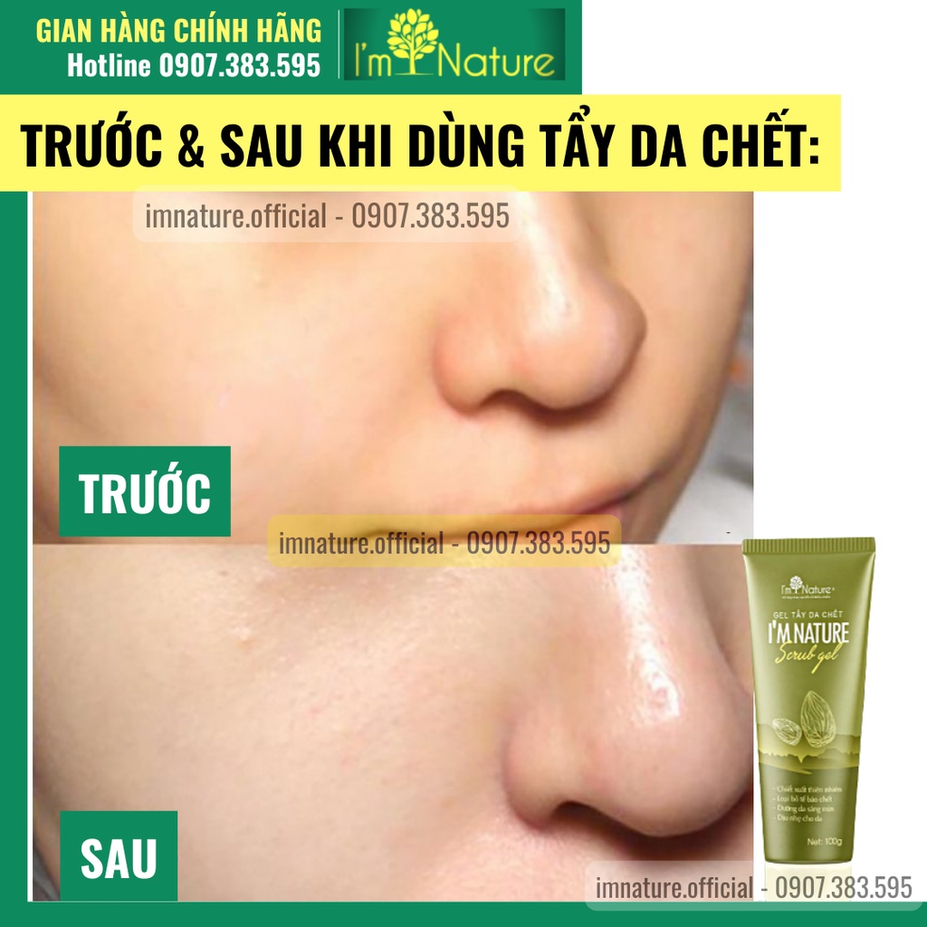 Gel Tẩy Da Chết I'm Nature Sáng Mịn Dưỡng Da 100gr - Dành Cho Da Mặt