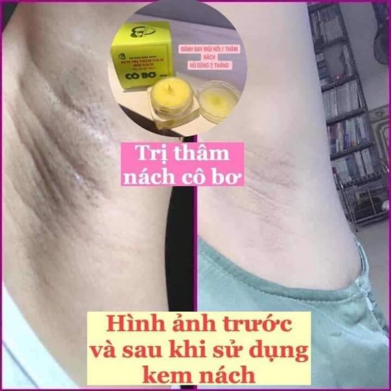 (TẶNG QUÀ XINH) COMBO 1 LỌ KEM LOẠI BỎ THÂM NÁCH - HÔI NÁCH CÔ BƠ