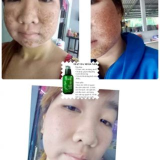 Thay da nhân sâm 500g