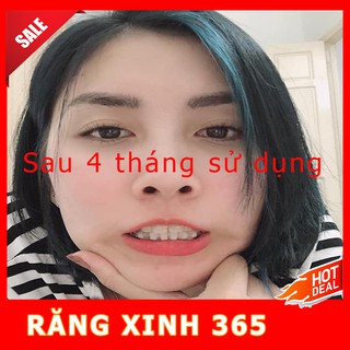 Niềng Răng Bí Mật ( Hàng Chính Hãng )