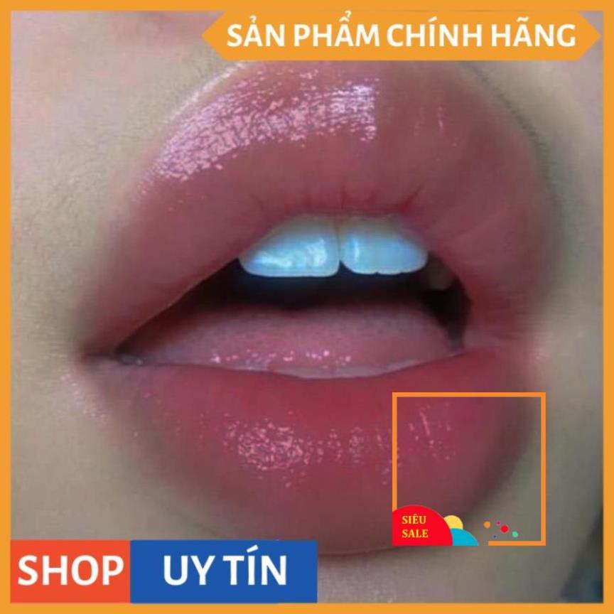 SON Ủ MÔI SHI - MỀN MÔI -DƯỠNG MÔI - HỒNG MÔI - TRỊ THÂM MÔI V V V