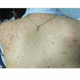 CÁM GẠO CÀ PHÊ NGUYÊN CHẤT
