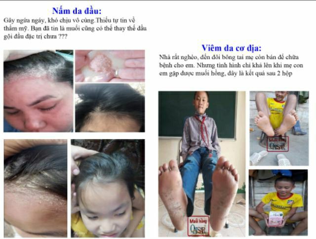 Muối hồng Hymalayan Qaisar - mẫu 100gr dùng thử