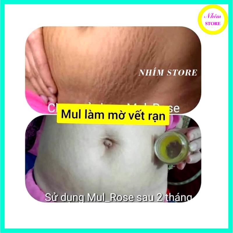 Kem Mul Rose dưỡng da an toàn