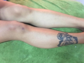 Ủ trắng da body cá hồi
