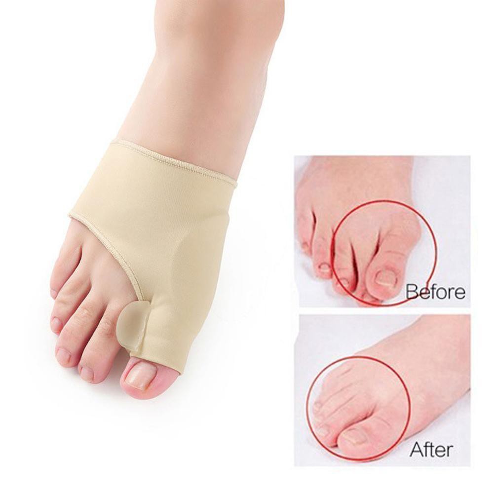 Dụng cụ nẹp bàn chân chỉnh ngón chân cái giúp giảm đau hiệu quả