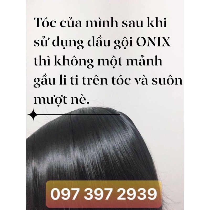 Dầu gội thảo mộc ONIX sạch gàu, giảm rụng, mọc tóc, thơm sảng khoái | BigBuy360 - bigbuy360.vn