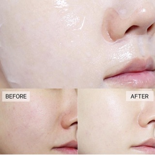 Mặt nạ Mediheal TEA TREE Healing Solution Essential Chính hãng