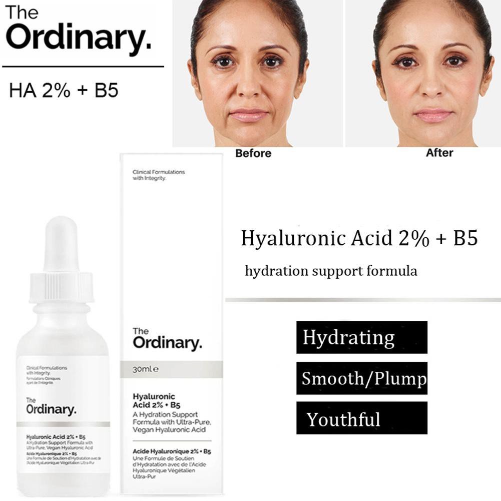 The Ordinary Hyaluronic Acid 2% + B5 phục hồi da, cấp ẩm - Serum B5 làm dịu da The Ordinary 30ml, 60ml