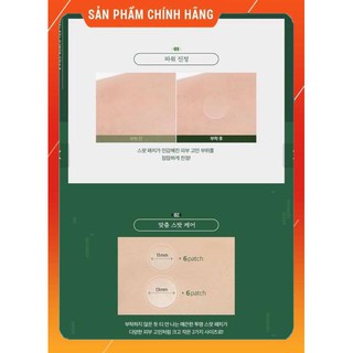 Miếng dán mụn Apieu Hàn Quốc xẹp mụn