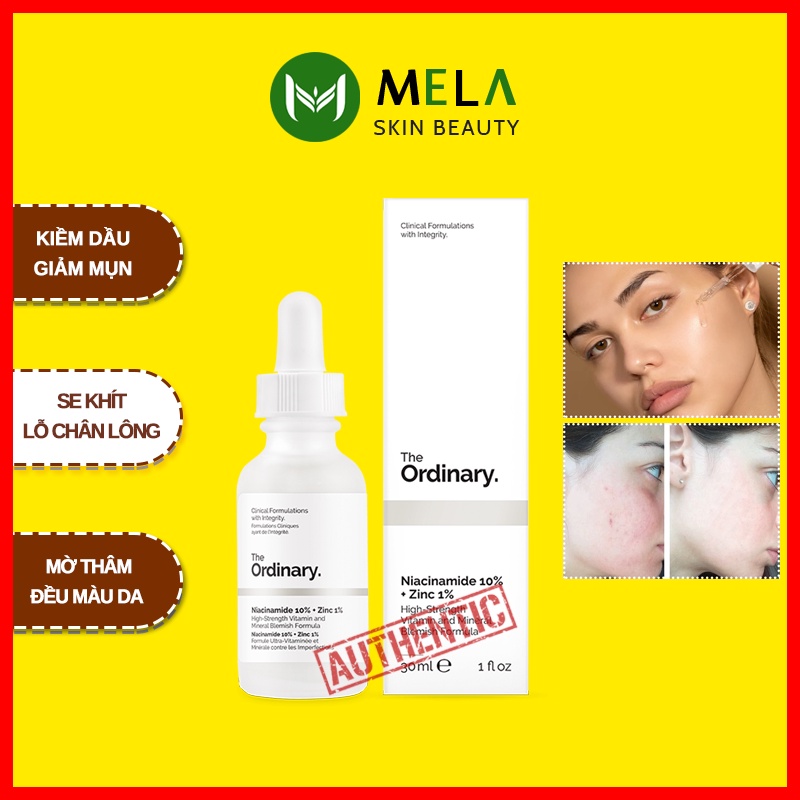 Serum The Ordinary Niacinamide 10% + Zinc 1% Tinh Chất Kiềm Dầu, Giảm Mụn, Se Khít Lỗ Chân Lông