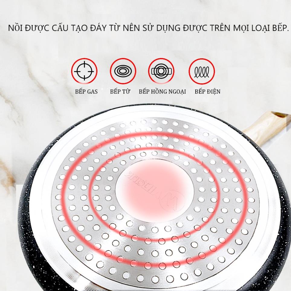 Nồi Nhôm Vân Đá Hoa Cương