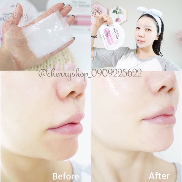 Mặt nạ dạng thuốc Banibagi Vita Genic Jelly Mask